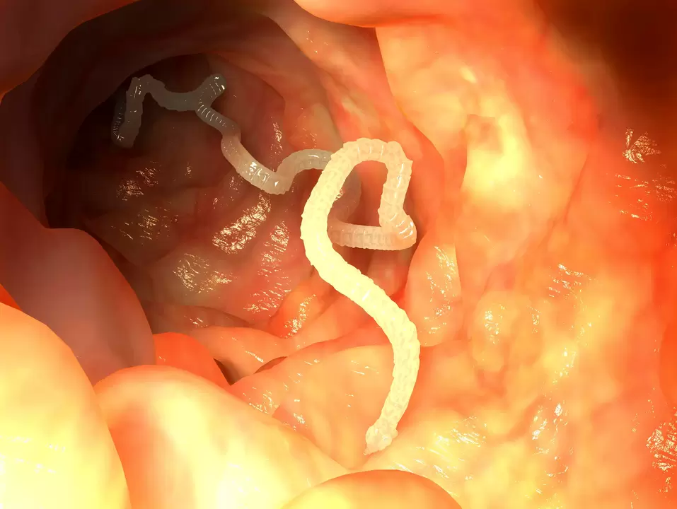 human esophagus worm parasites