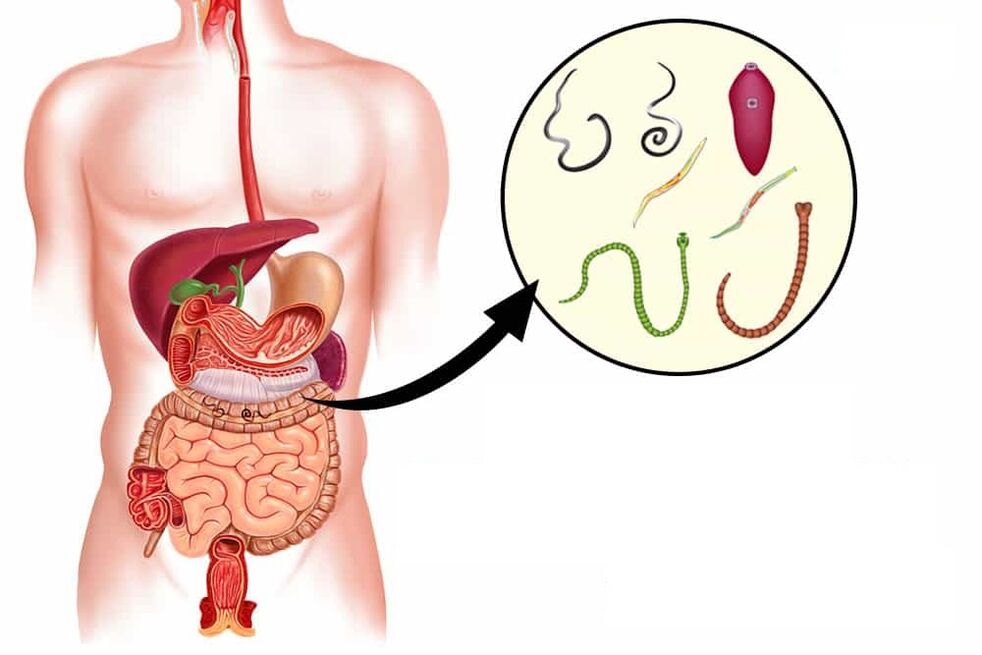 Many types of worms live in the human body