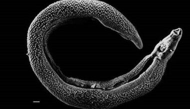 Parasites can live in a liver