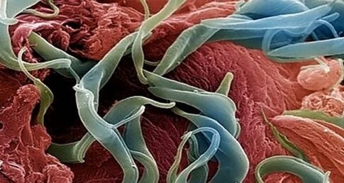 Image of parasites in the human body