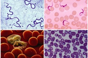 what the parasite can have in human blood